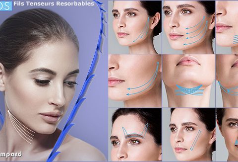 APTOS Fils tenseur resorbables