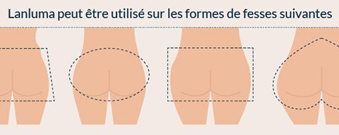 Lanluma forme fesses